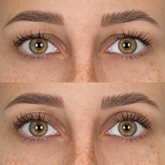 Parches Lift Párpados