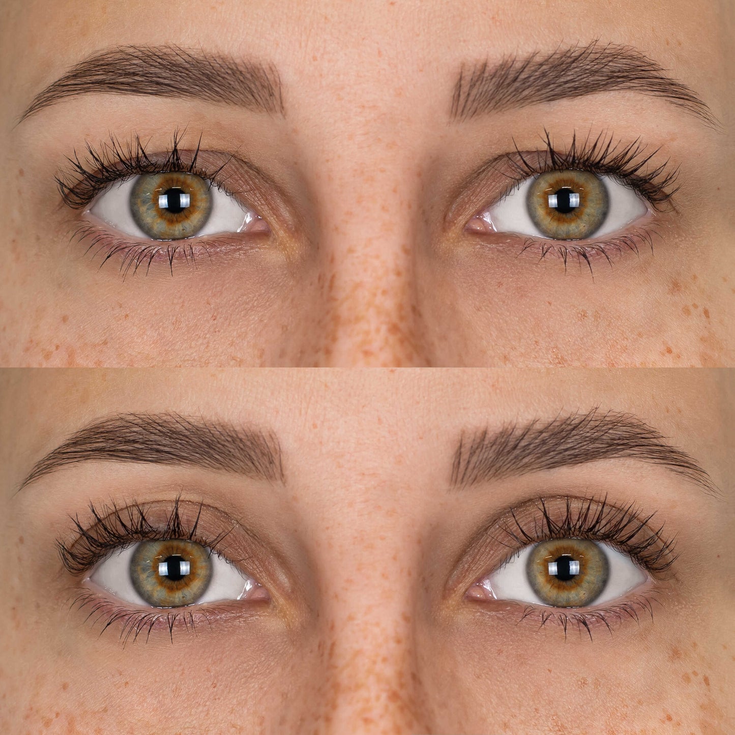 Parches Lift Párpados