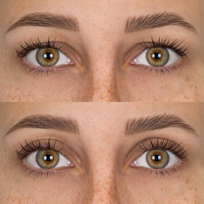 Parches Lift Párpados